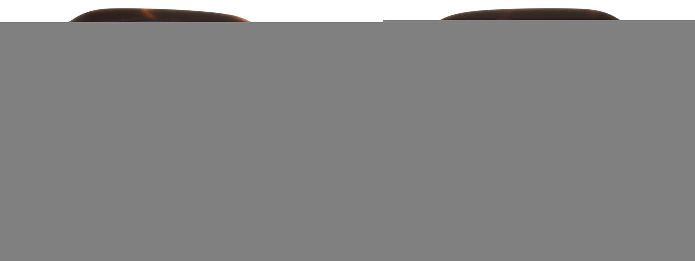 Direkt Optik B004804 11